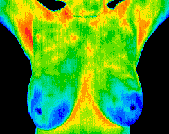 Normal breast image